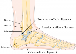 Ankle Sprains and Fractures