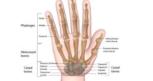 Hand Fractures