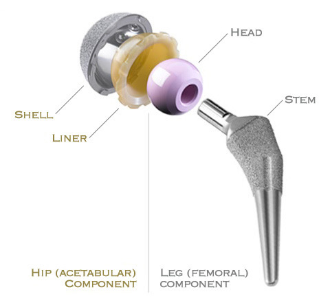 Prosthetic Hip Components description