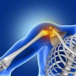 Shoulder conditions and treatments