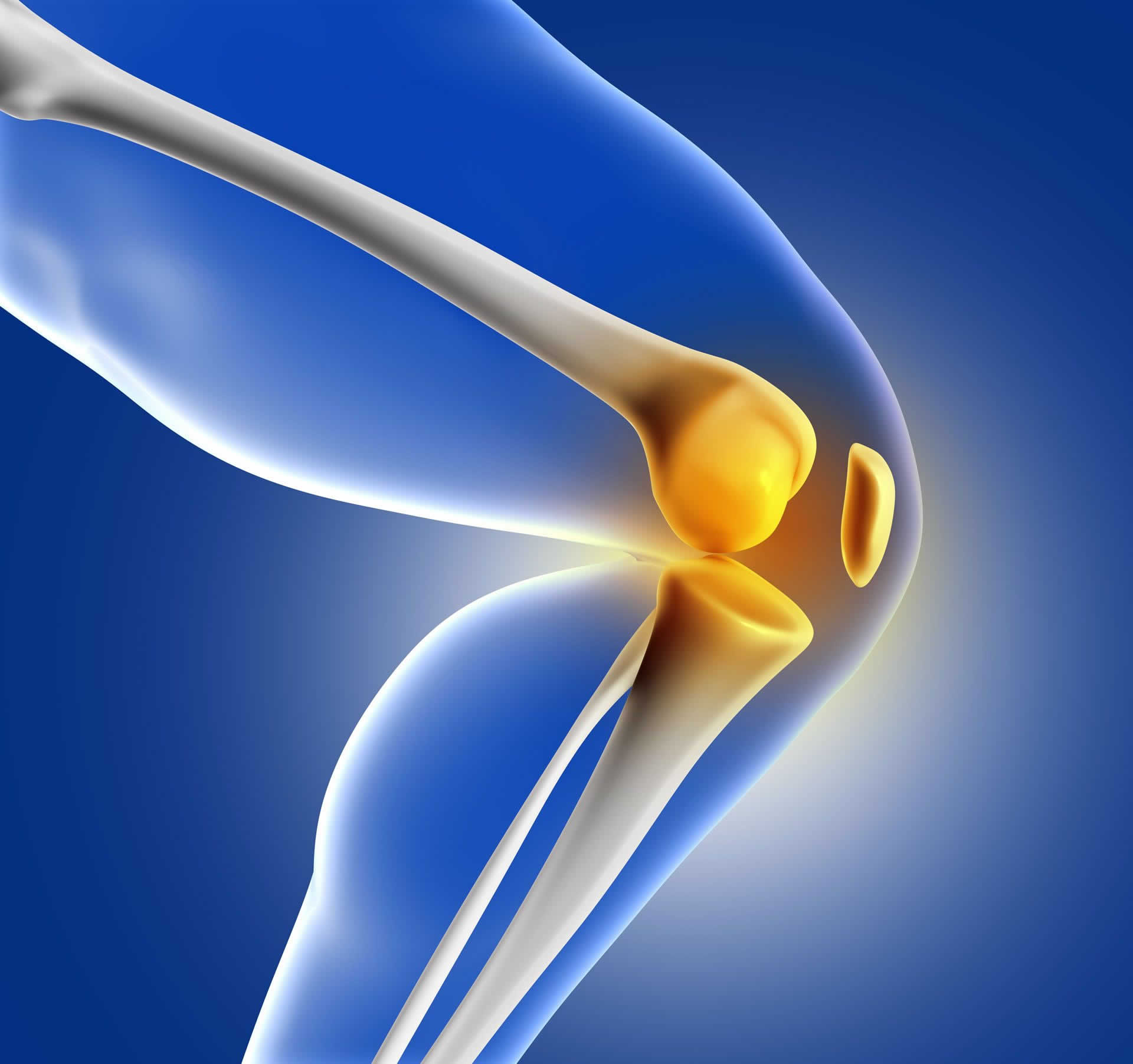 Complications of Knee Replacement | Joint Clinic Paarl